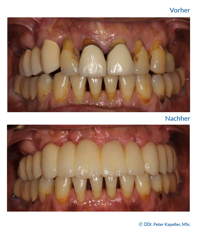 Zahnarztpraxis Implantart DDr. Kapeller MSc MSc und Dr. Dr. Nikola Dibold MSc MSc