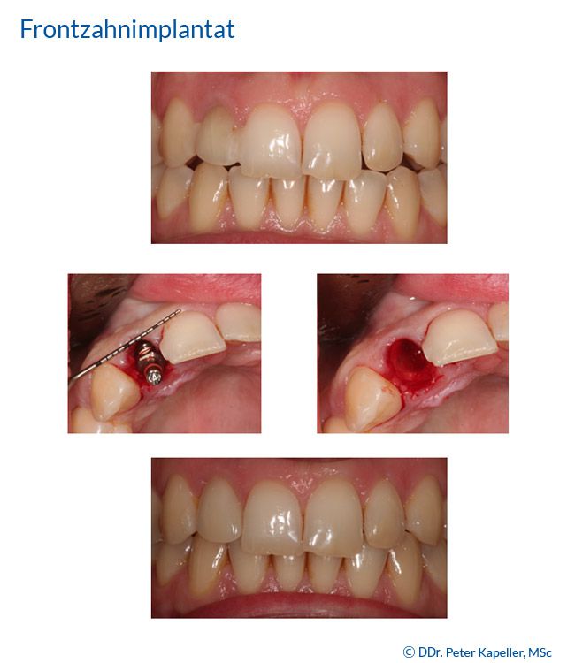 Zahnarztpraxis Implantart